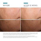 Discoloration Defense Correcting Serum 1 oz