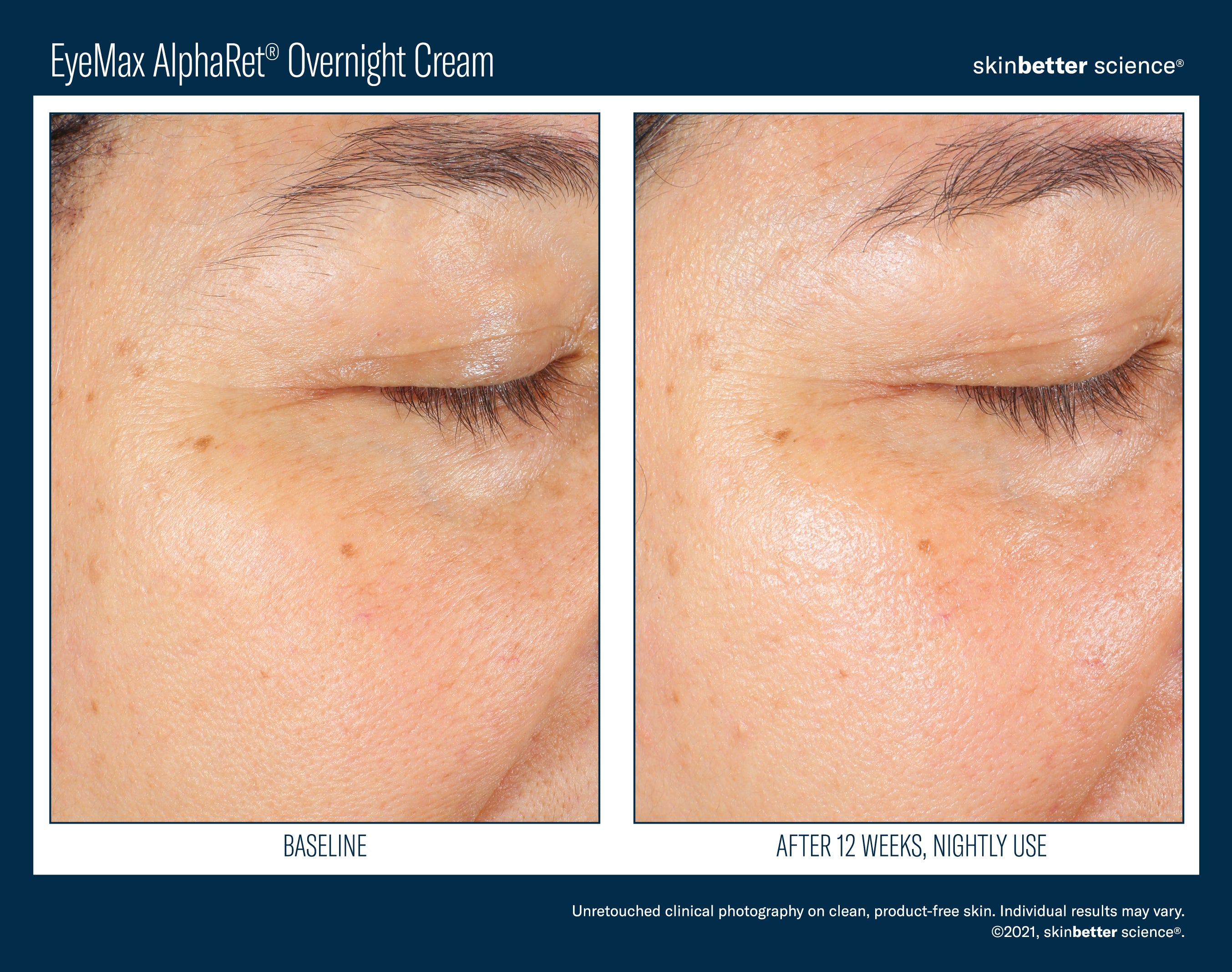 EyeMax AlphaRet Overnight Cream 15 ml