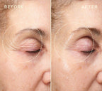 Filler Duo for Face and Lips GIFT SET