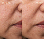 Filler Duo for Face and Lips GIFT SET