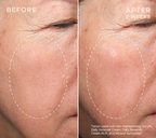 HA+ Replenishing Serum 30 ml