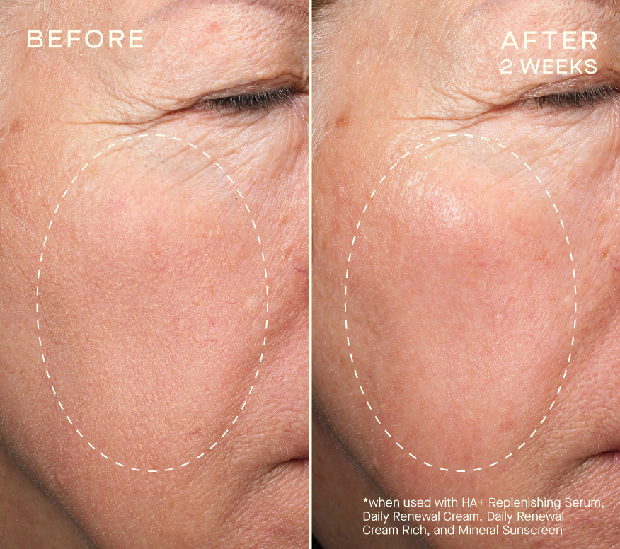 HA+ Replenishing Serum 30 ml