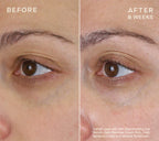 HA+ Replenishing Eye Serum 16.5 ml