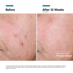Advanced RGN-6 Skin Regeneration Cream 1.7 oz