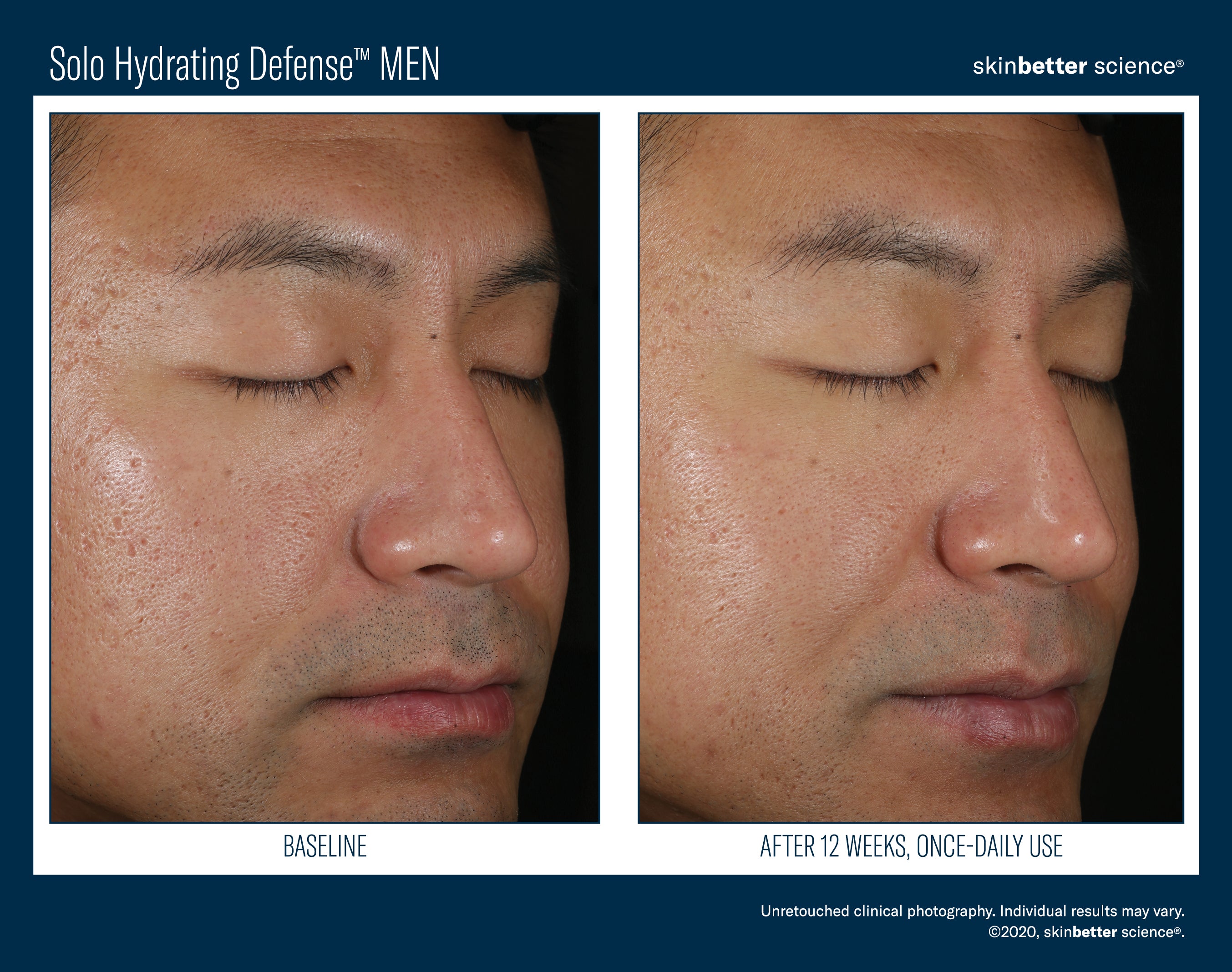Solo Hydrating Defense Men 50 ml