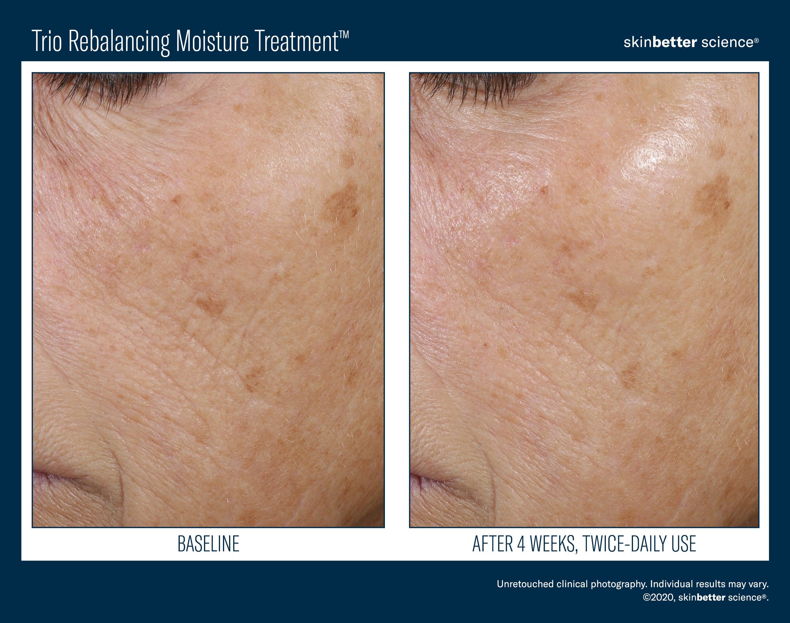 Trio Rebalancing Moisture Treatment 50 ml