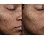 Complexion Brightening Serum 30 ml