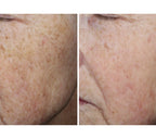 Complexion Brightening Serum 30 ml